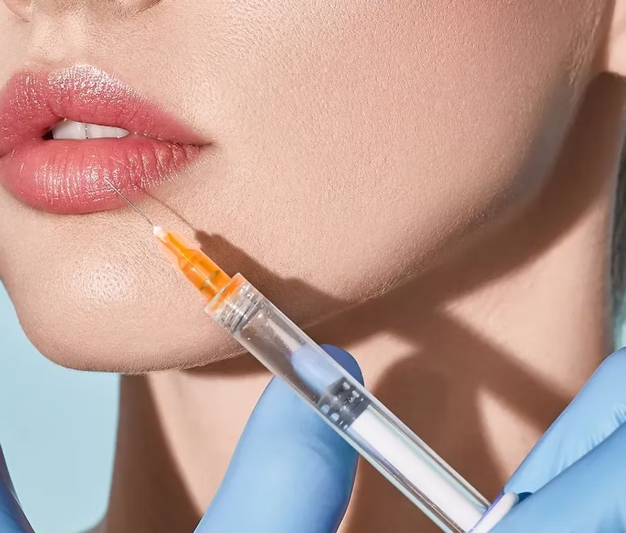 Lip Filler Juvederme