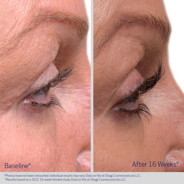 Obagi Nu-Cil EYELASH ENHANCING SERUM gallery 3