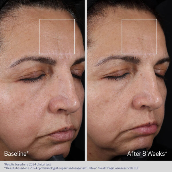 ELASTIDERM ADVANCED FILLER CONCENTRATE gallery 5