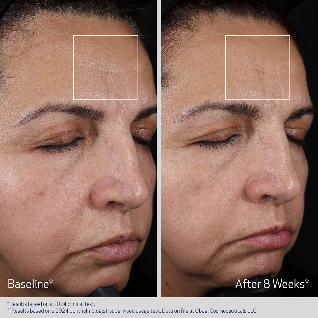ELASTIDERM ADVANCED FILLER CONCENTRATE gallery 5