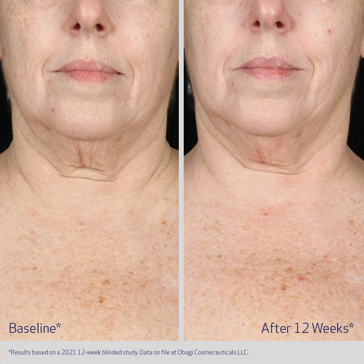 ELASTIDERM NECK AND DÉCOLLETÉ CONCENTRATE gallery 5