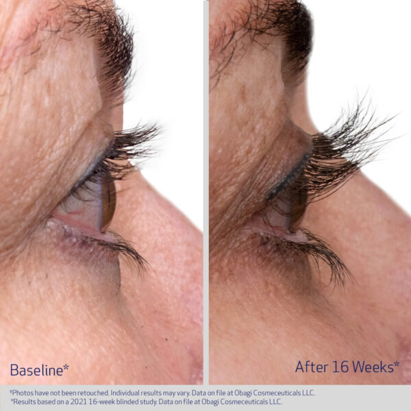 Obagi Nu-Cil EYELASH ENHANCING SERUM gallery 4