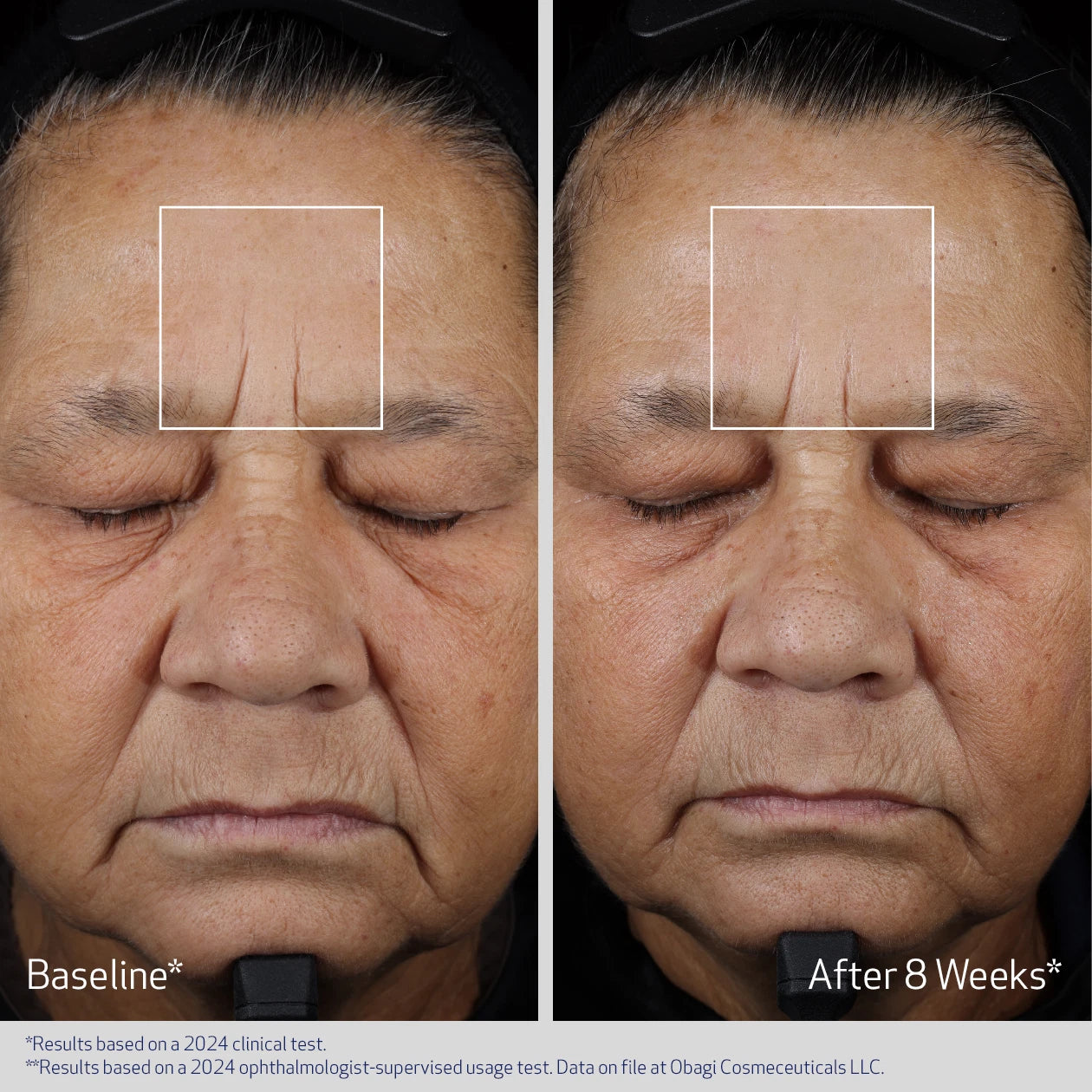 ELASTIDERM ADVANCED FILLER CONCENTRATE gallery 6