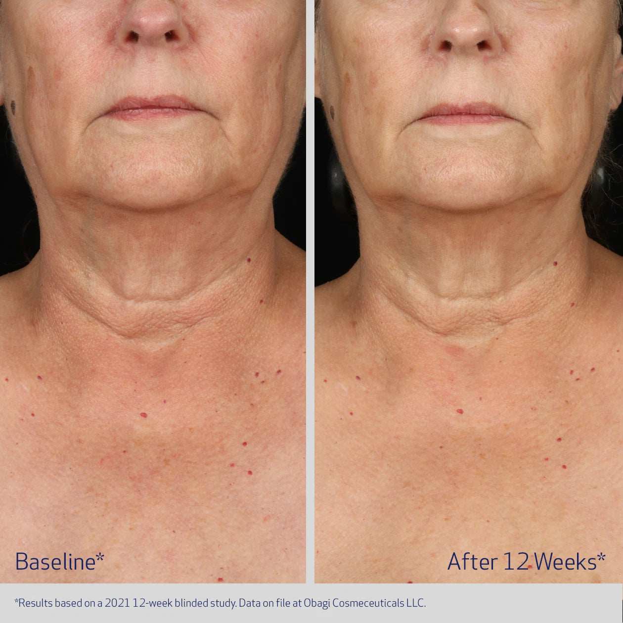 ELASTIDERM NECK AND DÉCOLLETÉ CONCENTRATE gallery 6