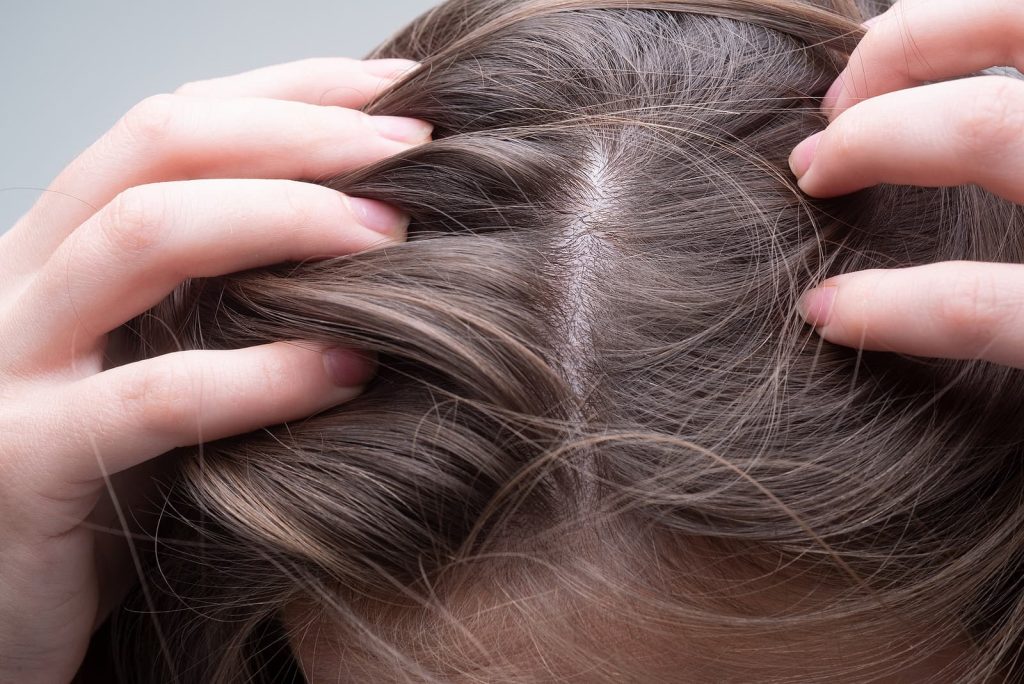 hydrafacial shoreditch - woman examining her scalp and hair