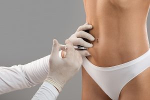 lemon bottle treatment london - Fat Dissolving Injections