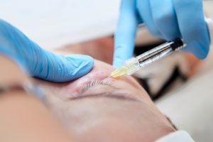polynucleotide treatment london - procedure of biorevitalization in the area of eyes
